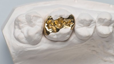 Gold-Inlay